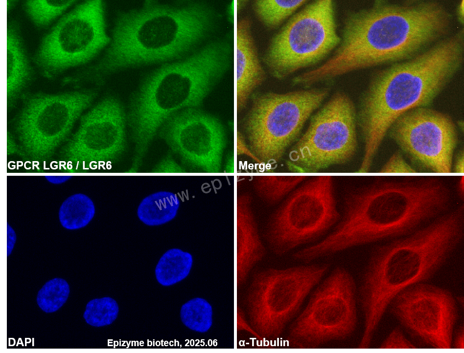 Anti-GPCR LGR6 Rabbit mAb [64K62M94]