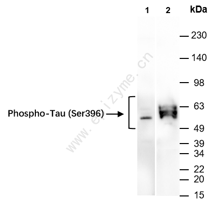 Anti-Phospho-Tau (Ser396) Rabbit mAb [28F74E24]