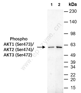 Anti-Phospho-AKT1 (Ser473)/AKT2 (Ser474)/AKT3 (Ser472) Rabbit mAb [30P57N10]