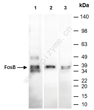 Anti-Fos B Rabbit mAb [67I75H74]