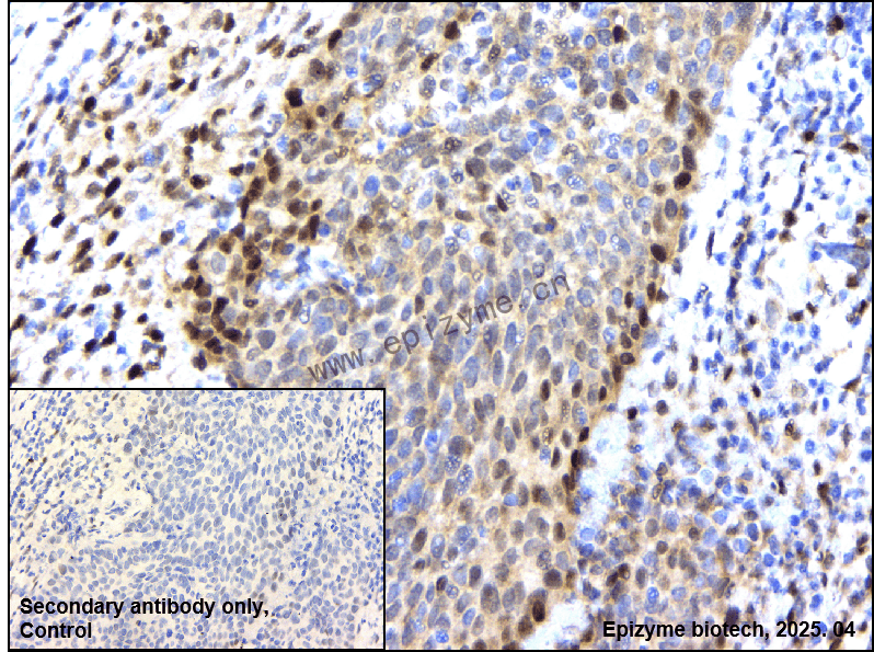 Anti-Fos B Rabbit mAb [67I75H74]