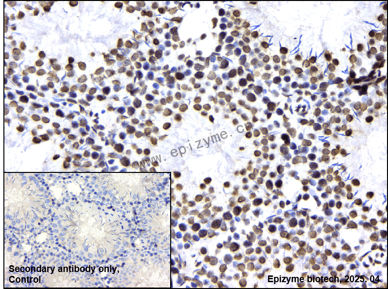 Anti-RAPGEF5 Rabbit mAb [62B58G81]