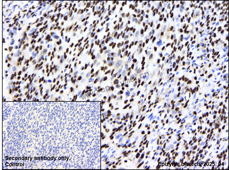 Anti-RAPGEF5 Rabbit mAb [62B58G81]