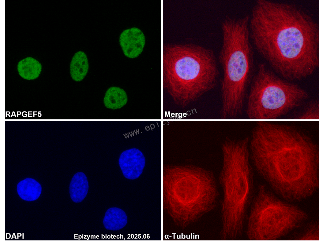 Anti-RAPGEF5 Rabbit mAb [62B58G81]