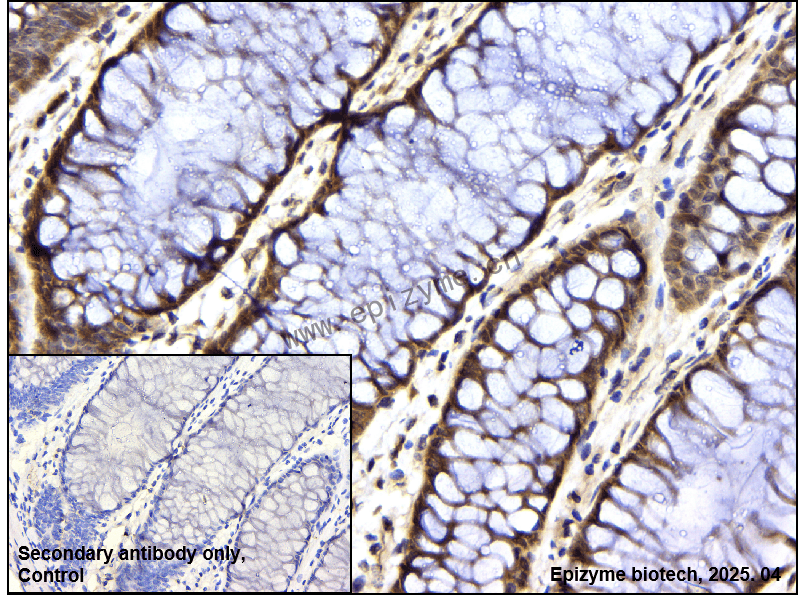 Anti-PKC beta 1 Rabbit mAb [52R71Y63]