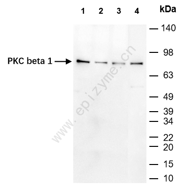 Anti-PKC beta 1 Rabbit mAb [52R71Y63]