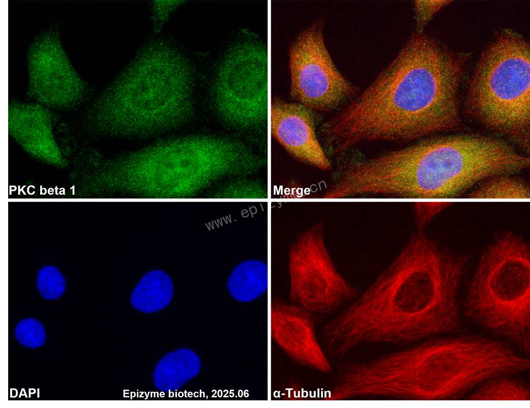 Anti-PKC beta 1 Rabbit mAb [52R71Y63]