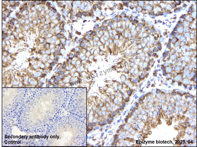 Anti-Bcl2 L14 Rabbit mAb [60D71C62]