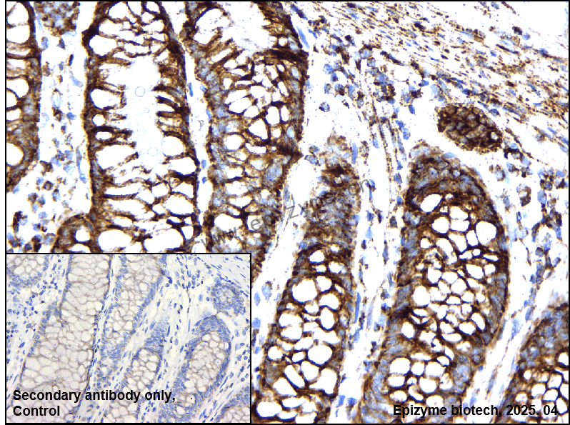 Anti-Bcl2 L14 Rabbit mAb [60D71C62]
