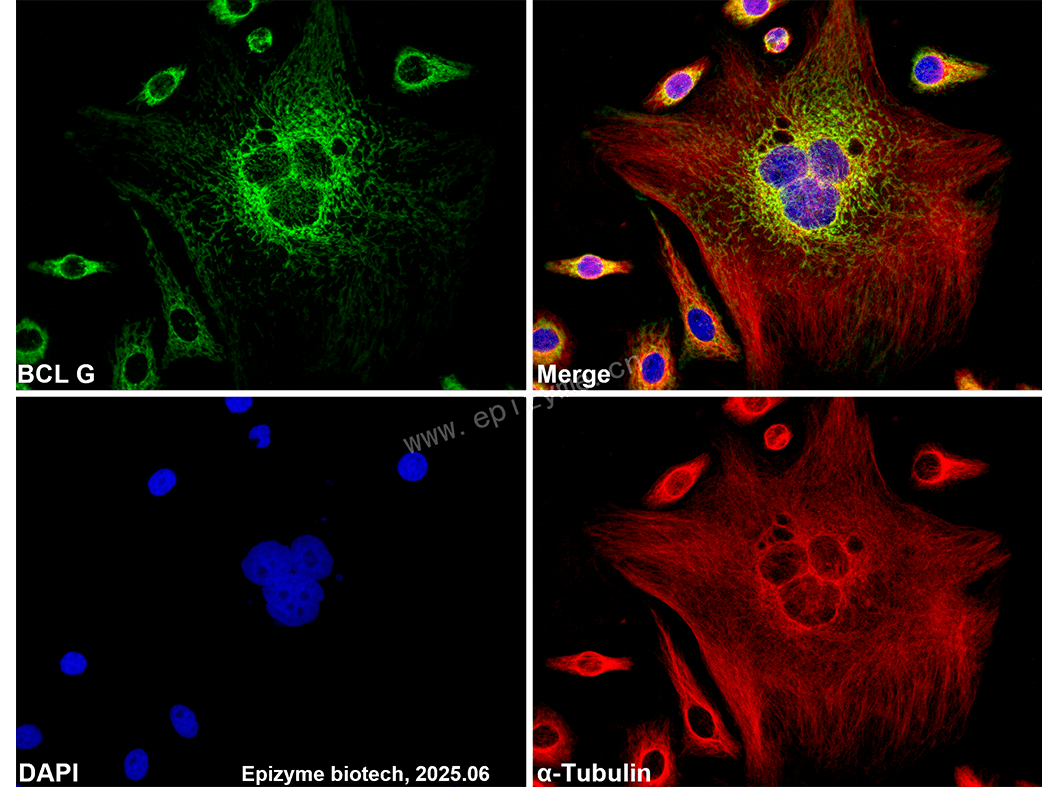 Anti-Bcl2 L14 Rabbit mAb [60D71C62]