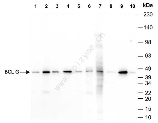 Anti-Bcl2 L14 Rabbit mAb [60D71C62]
