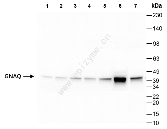 Anti-GNAQ Rabbit mAb [84F25F60]