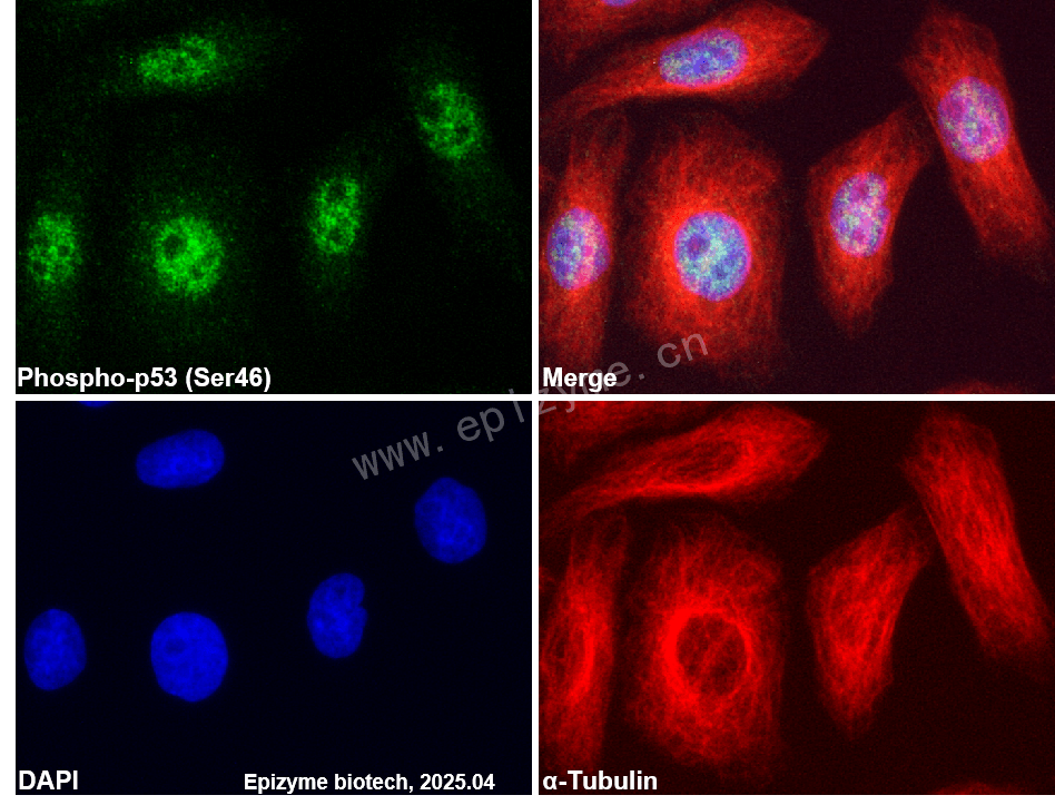 Anti-Phospho-p53 (Ser46) Rabbit mAb [34F39D14]