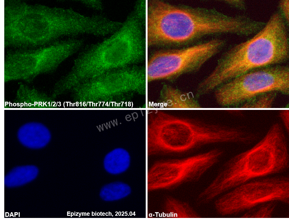 Anti-Phospho-PRK1/2/3 (Thr816/Thr774/Thr718) Rabbit mAb [94D74P36]