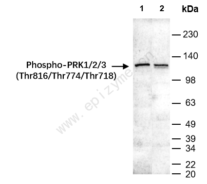 Anti-Phospho-PRK1/2/3 (Thr816/Thr774/Thr718) Rabbit mAb [94D74P36]
