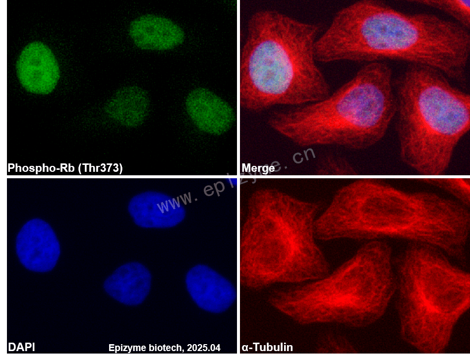 Anti-Phospho-Rb (Thr373) Rabbit mAb [54C33H63]