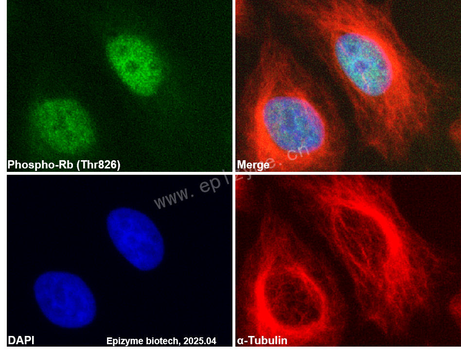 Anti-Phospho-Rb (Thr826) Rabbit mAb [45G70D19]