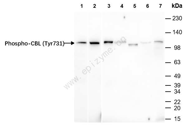 Anti-Phospho-CBL (Tyr731) Rabbit mAb [41Q30A56]