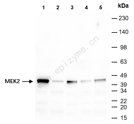 Anti-MEK2 Rabbit mAb [52E19E30]