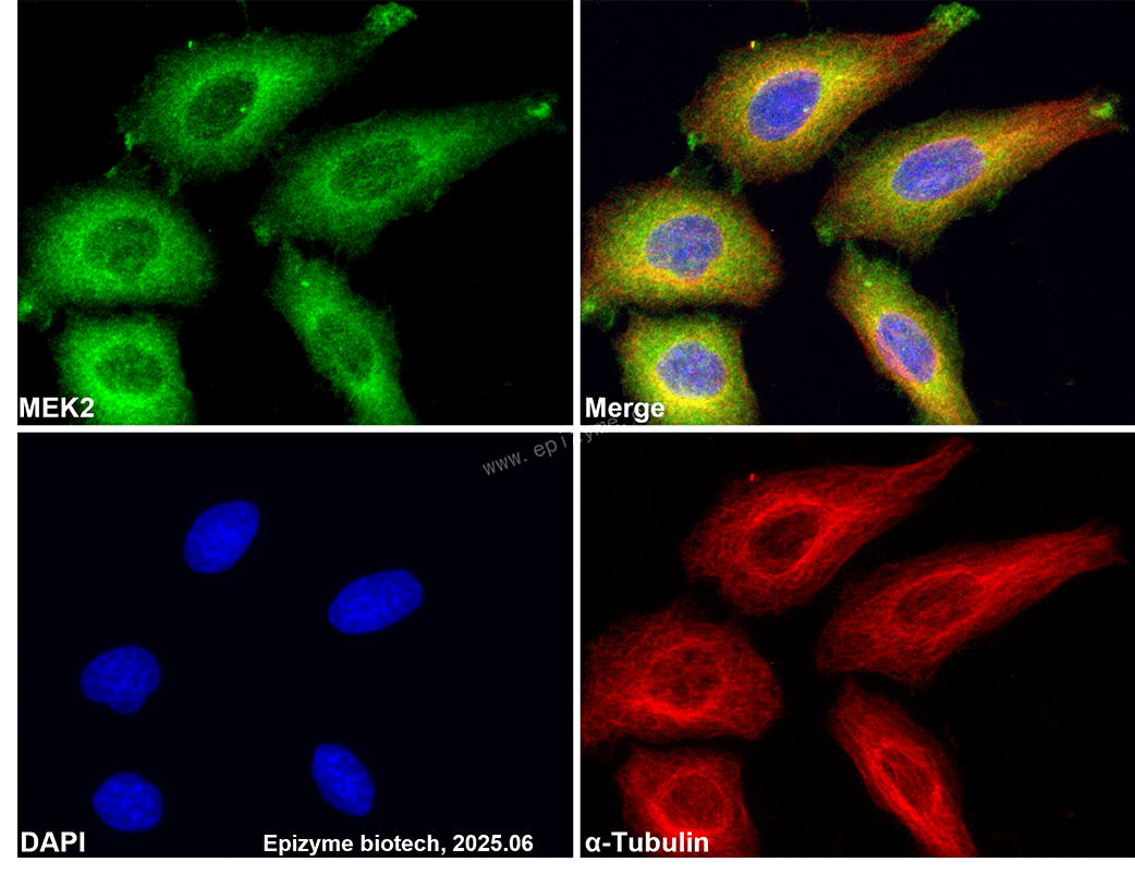 Anti-MEK2 Rabbit mAb [52E19E30]
