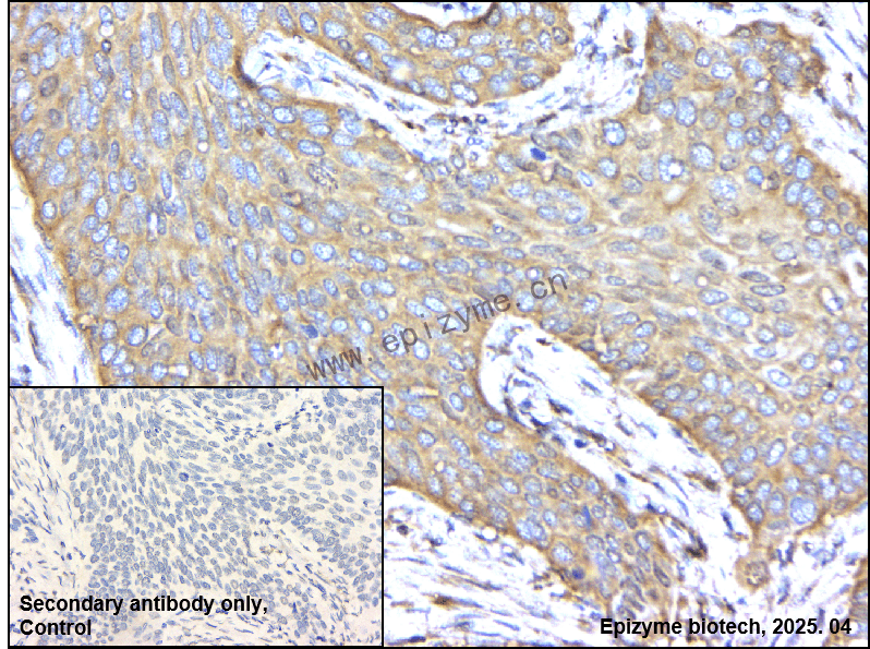 Anti-MEK2 Rabbit mAb [52E19E30]
