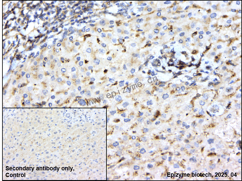 Anti-MEK2 Rabbit mAb [52E19E30]