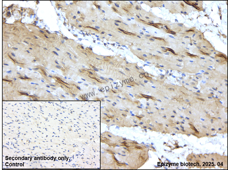 Anti-MLCK Rabbit mAb [26S15K06]