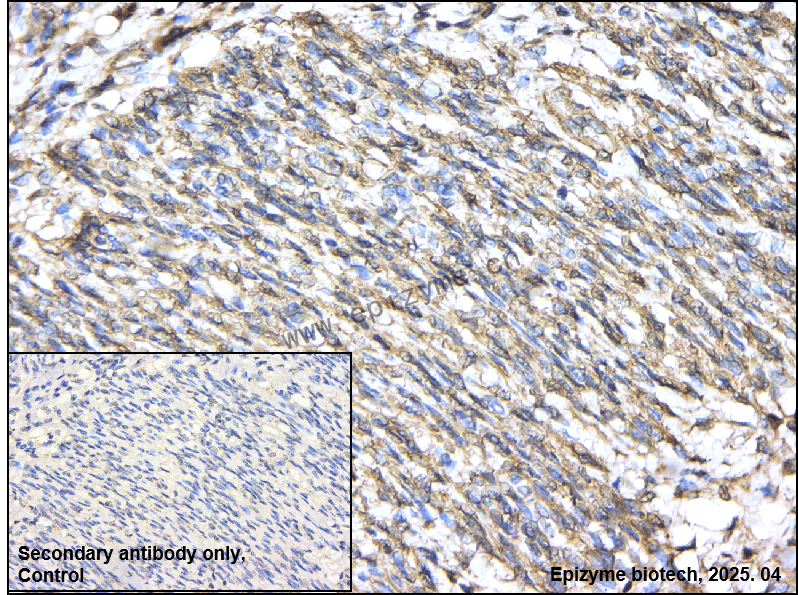 Anti-MLCK Rabbit mAb [26S15K06]