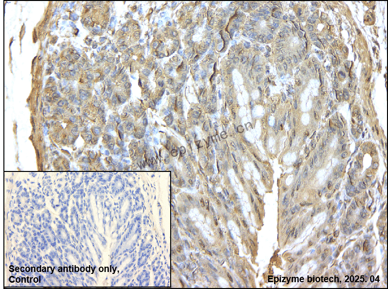 Anti-MLCK Rabbit mAb [26S15K06]