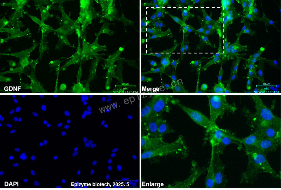 Anti-GDNF Rabbit mAb [23P45A82]