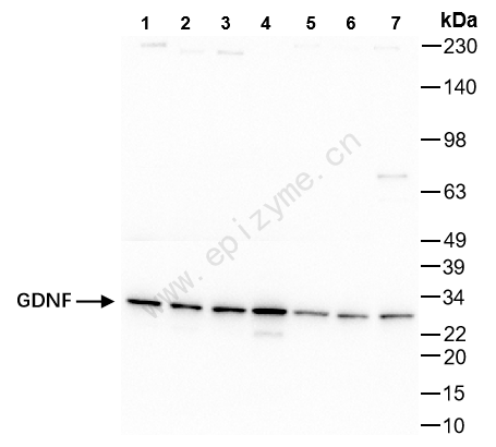 Anti-GDNF Rabbit mAb [23P45A82]