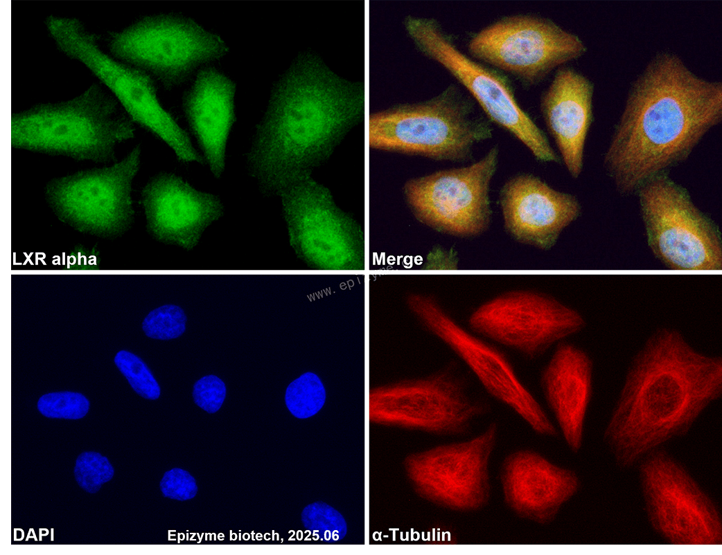 Anti-LXR alpha Rabbit mAb [53P76K15]