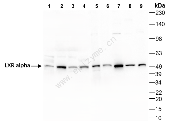 Anti-LXR alpha Rabbit mAb [53P76K15]