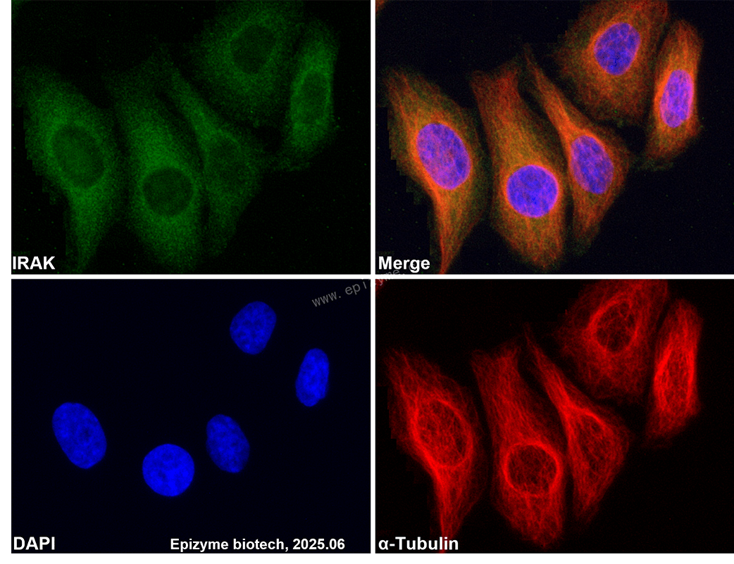 Anti-IRAK1 Rabbit mAb [35F09D38]