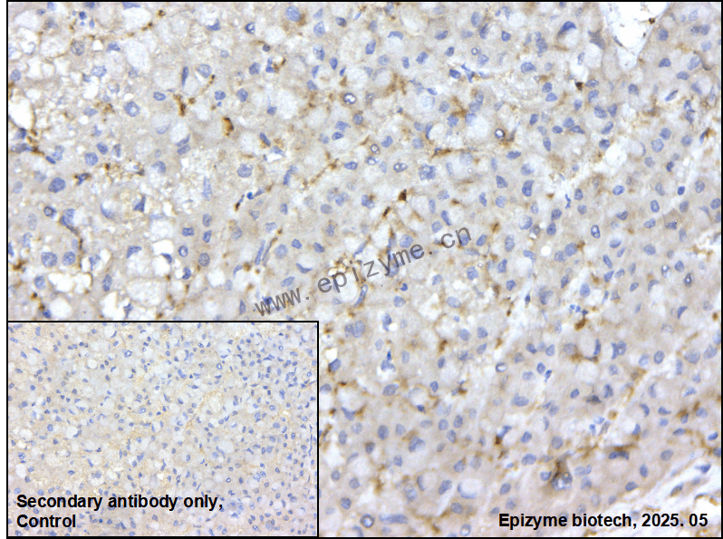Anti-PIAS2 Rabbit mAb [39Y38D29]