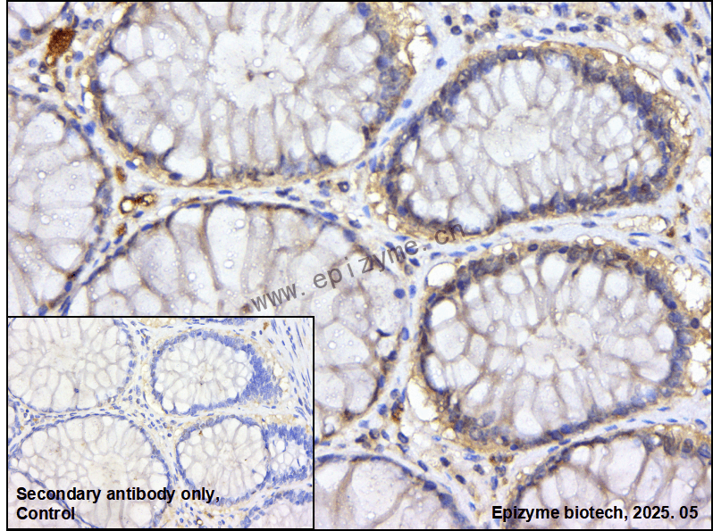 Anti-PIAS2 Rabbit mAb [39Y38D29]