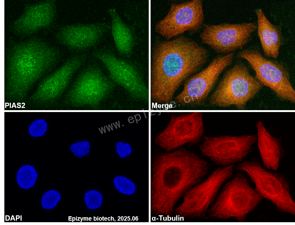 Anti-PIAS2 Rabbit mAb [39Y38D29]