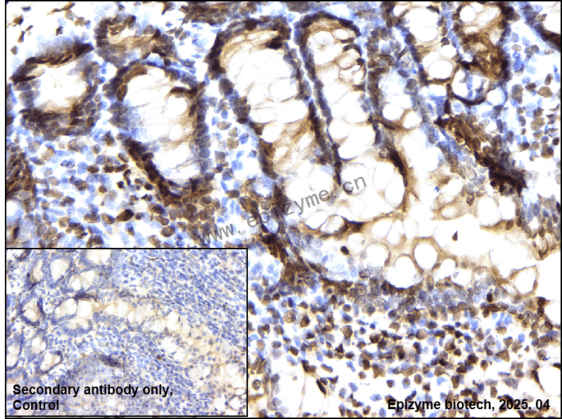 Anti-Macro H2A.1 Rabbit mAb [80B85H86]