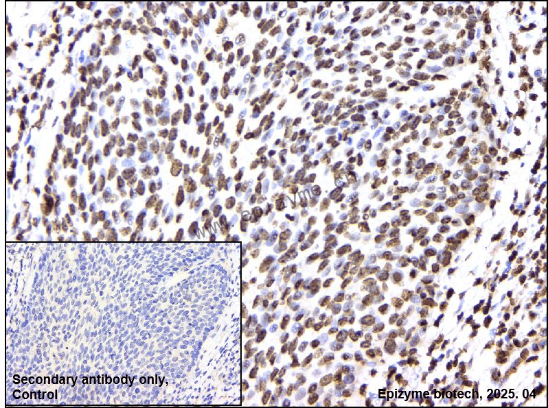 Anti-Macro H2A.1 Rabbit mAb [80B85H86]