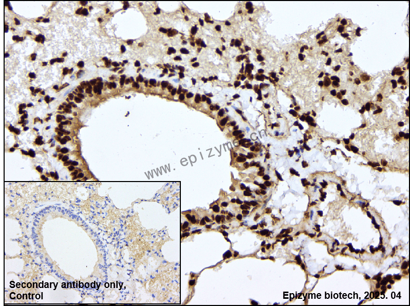 Anti-Macro H2A.1 Rabbit mAb [80B85H86]