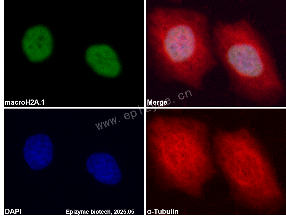 Anti-Macro H2A.1 Rabbit mAb [80B85H86]