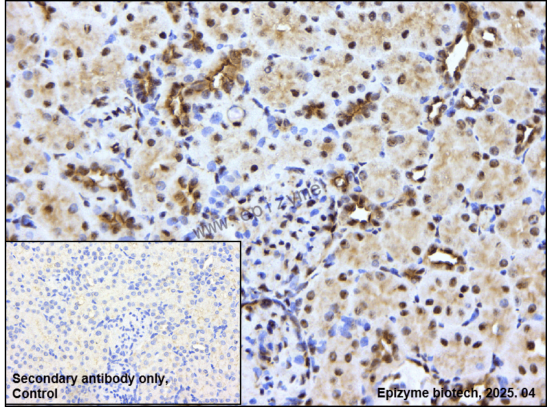 Anti-Phospho-PAK4/5/6 (Ser474/Ser560/Ser602) Rabbit mAb [24P90Y33]