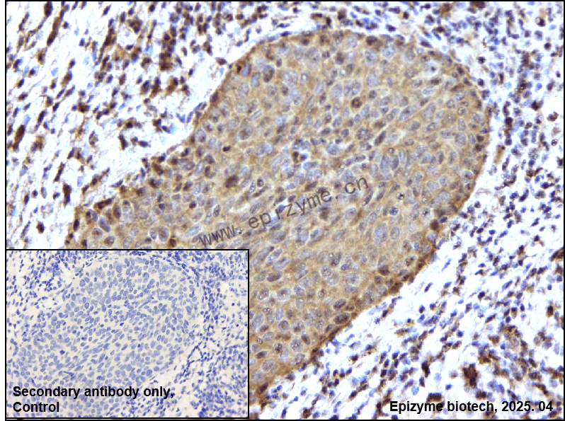 Anti-Phospho-PAK4/5/6 (Ser474/Ser560/Ser602) Rabbit mAb [24P90Y33]