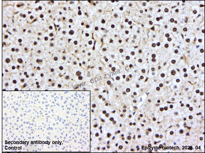 Anti-Phospho-PAK4/5/6 (Ser474/Ser560/Ser602) Rabbit mAb [24P90Y33]