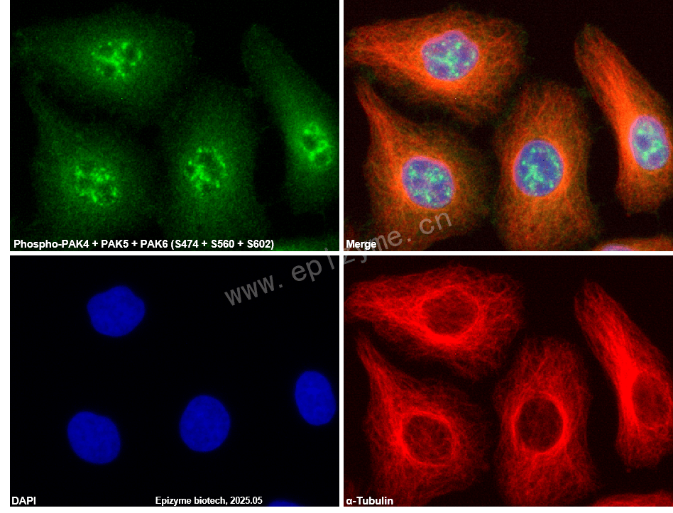 Anti-Phospho-PAK4/5/6 (Ser474/Ser560/Ser602) Rabbit mAb [24P90Y33]
