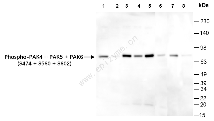 Anti-Phospho-PAK4/5/6 (Ser474/Ser560/Ser602) Rabbit mAb [24P90Y33]