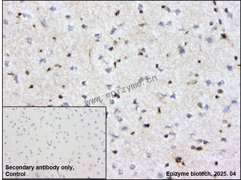 Anti-TAK1 Rabbit mAb [20G80N82]