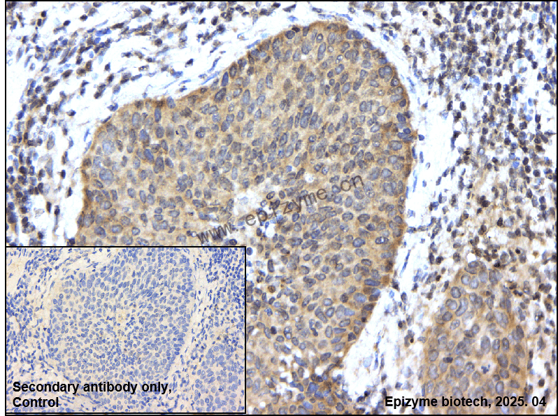 Anti-TAK1 Rabbit mAb [20G80N82]