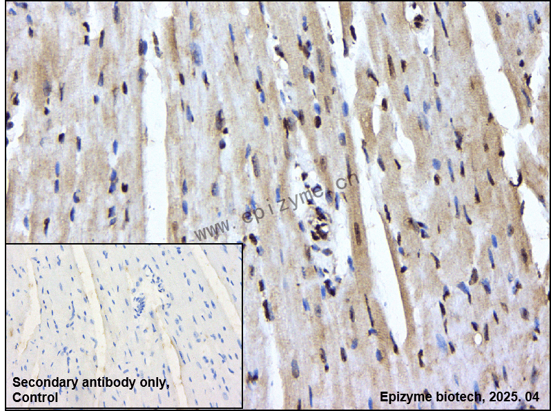 Anti-TAK1 Rabbit mAb [20G80N82]