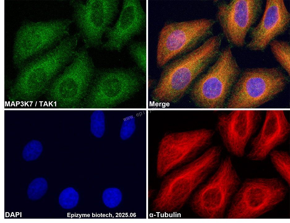 Anti-TAK1 Rabbit mAb [20G80N82]